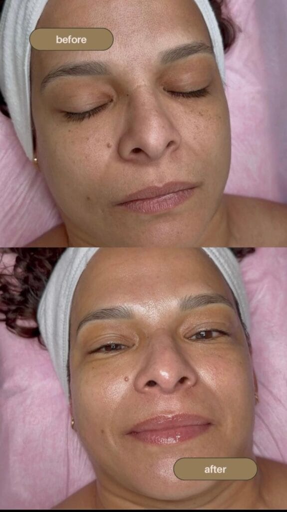 Facial-Deep Cleansing